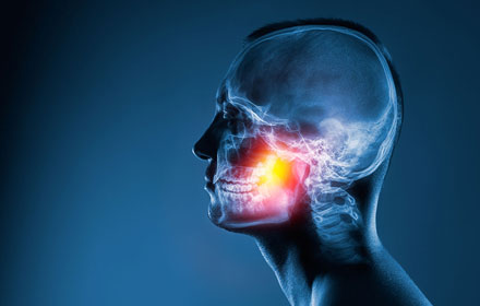 neuromuscular dentistry
