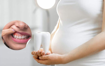 pregnancy oral health