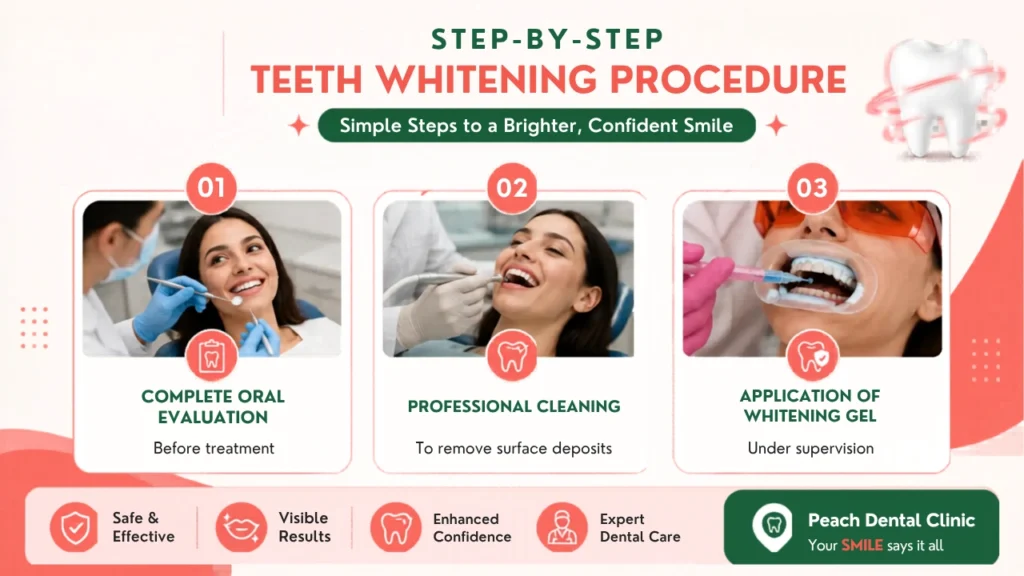 Step-by-Step Professional Teeth Whitening Procedure in Chennai
