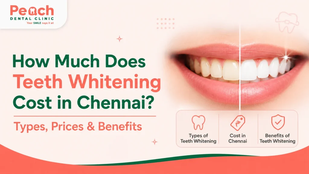 How Much Does Teeth Whitening Cost in Chennai? Types, Prices & Benefits Professional teeth whitening treatment showing a bright white smile with teeth whitening cost in Chennai, including treatment types, prices, and benefits.