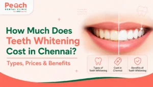 News Corner Professional teeth whitening treatment showing a bright white smile with teeth whitening cost in Chennai, including treatment types, prices, and benefits.