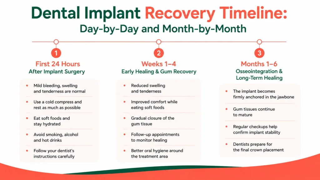 Understanding the Dental Implant Recovery Timeline from Surgery to Healing Peach Blog 4 Info 1 1 1024x577