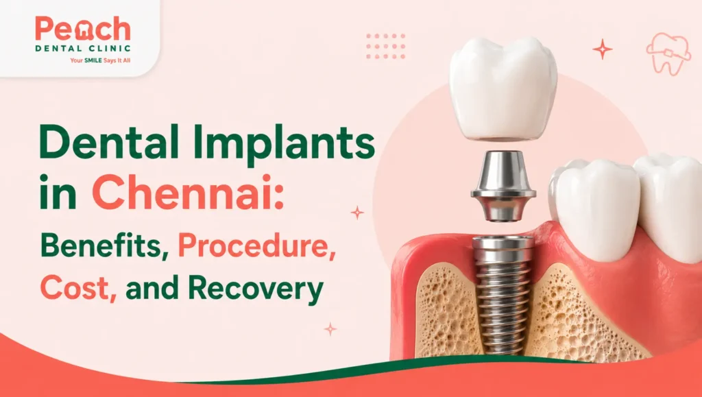 Dental implants in Chennai showing implant structure with crown, abutment, and titanium implant for tooth replacement.