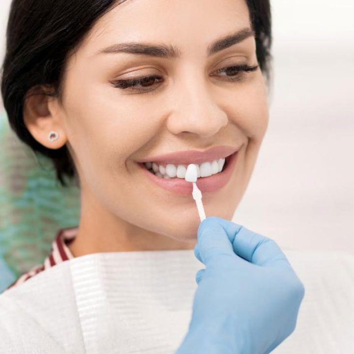 smile design